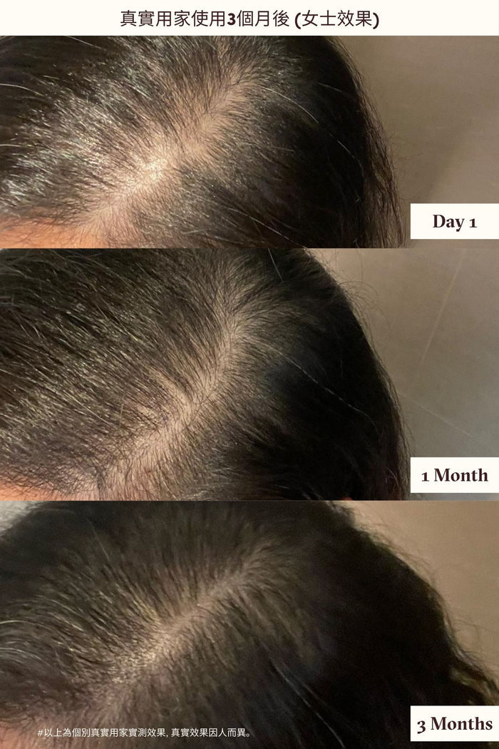 Hair Serum After 3 Months