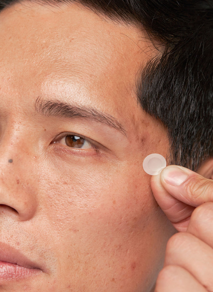 Deep Blemish Microdarts