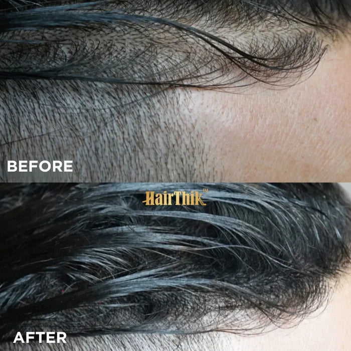 HairThik Dark Brown Hair Fibers - 15 Grams