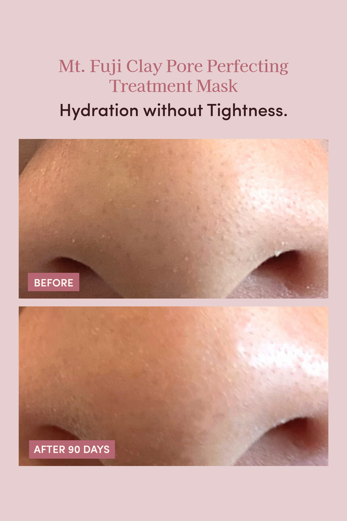 MT.FUJI CLAY PORE PERFECTING TREATMENT MASK