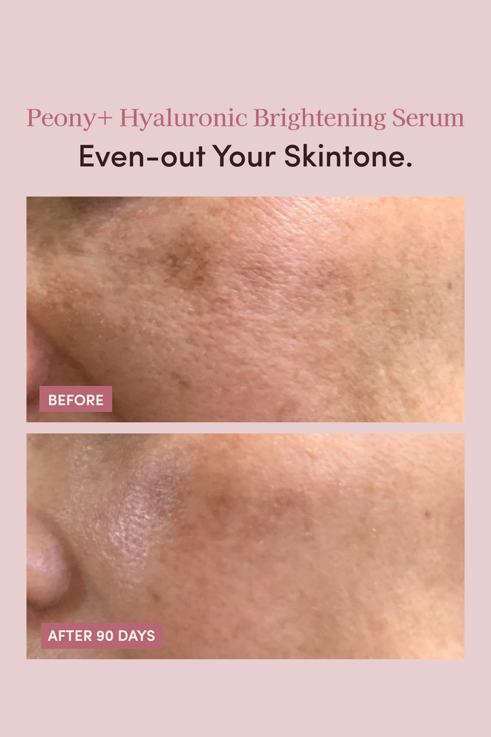 PEONY+ HYALURONIC BRIGHTENING SERUM - LOW STOCK