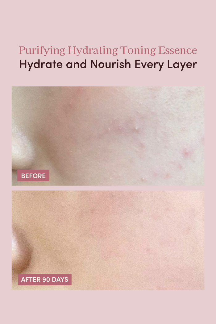 PURIFYING HYDRATING TONING ESSENCE