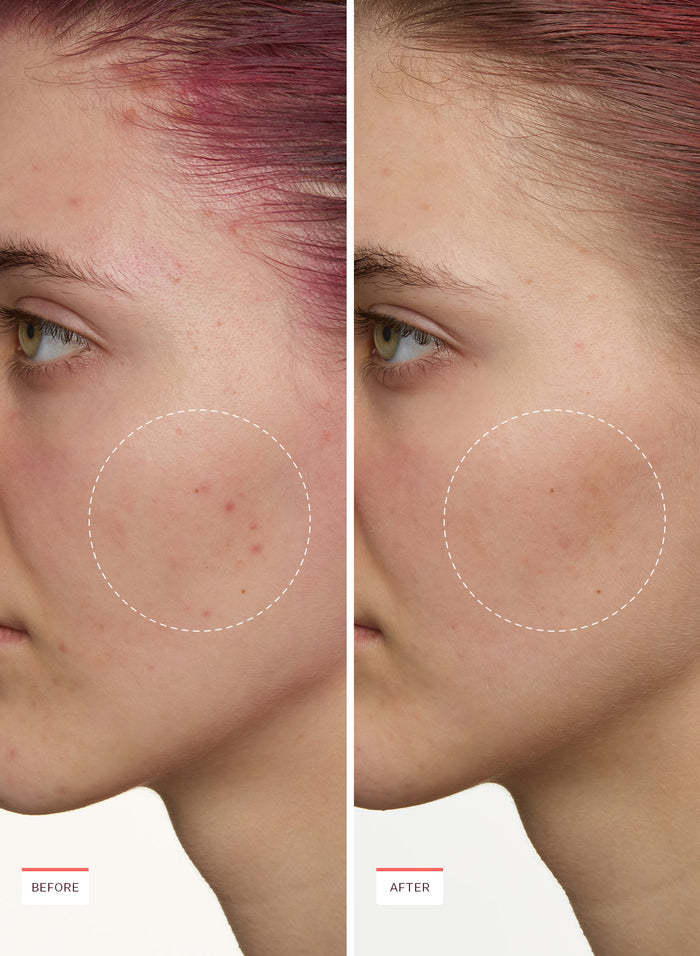 Super Fade Discoloration Moisturizer